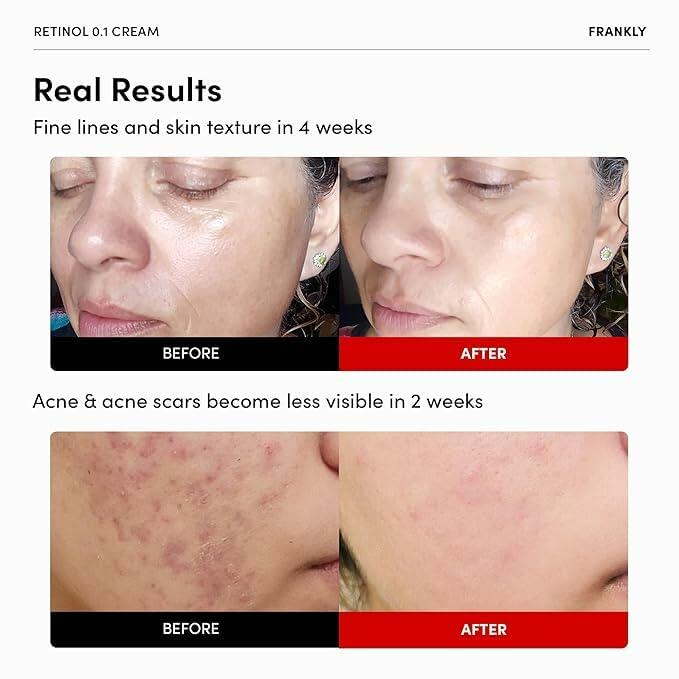 FRANKLY Retinol 0.1% Night Cream | Korean Anti-Aging Skincare 1.01oz
