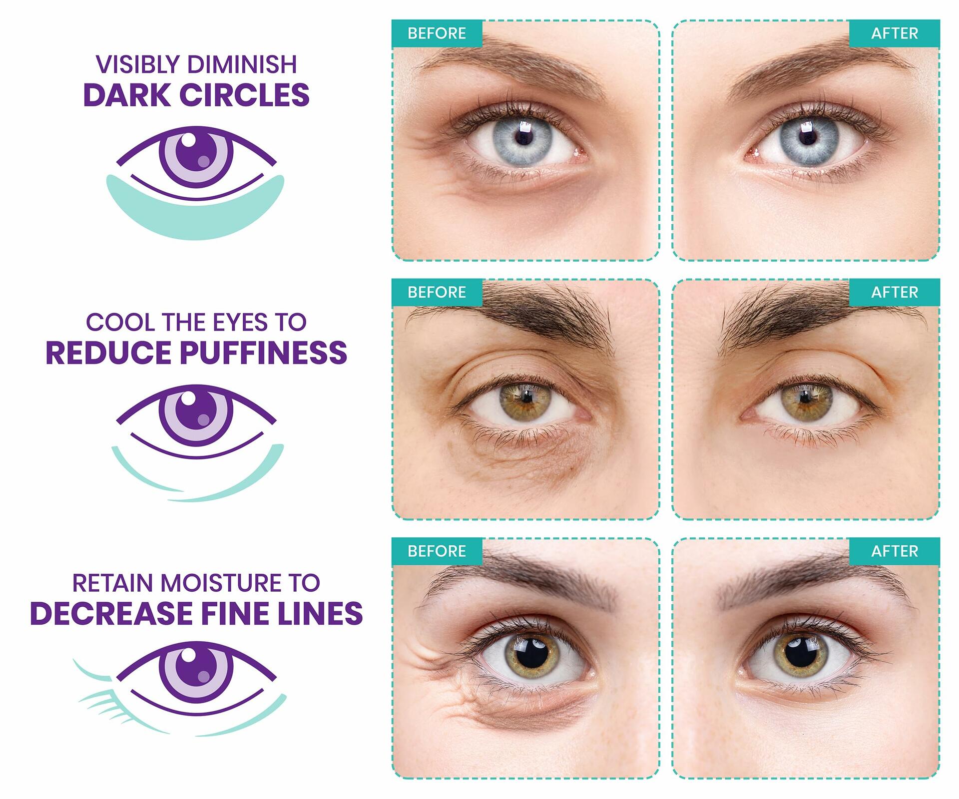 Stylia Under Eye Patches | Marine Collagen, Retinol & Vitamin C - 6 Pairs